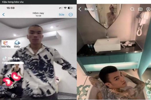 Vợ Long 9 ngón lộ bướm nhiều lông